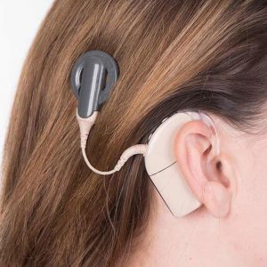 FDA Approves First Telehealth Option to Program Cochlear Implants Remotely