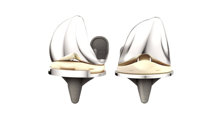 New ATTUNE® Revision Knee System From DePuy Synthes - IData Research