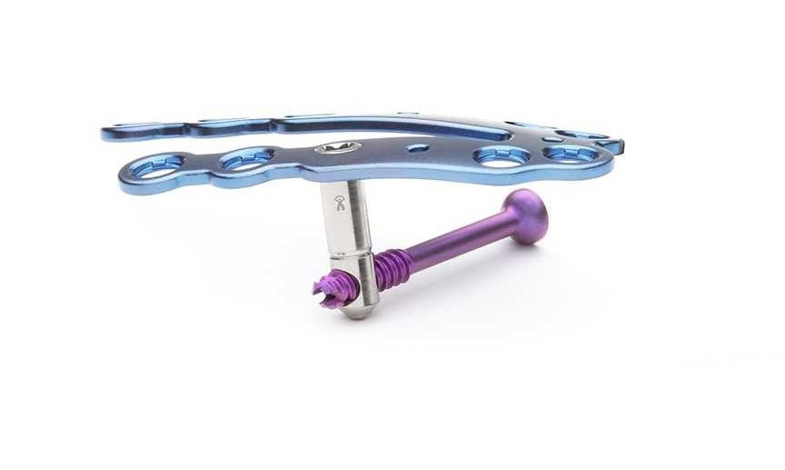 Extremity Medical Announces the Release of the Omni Plating System