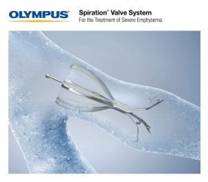 Olympus Launches Spiration Device for Emphysema