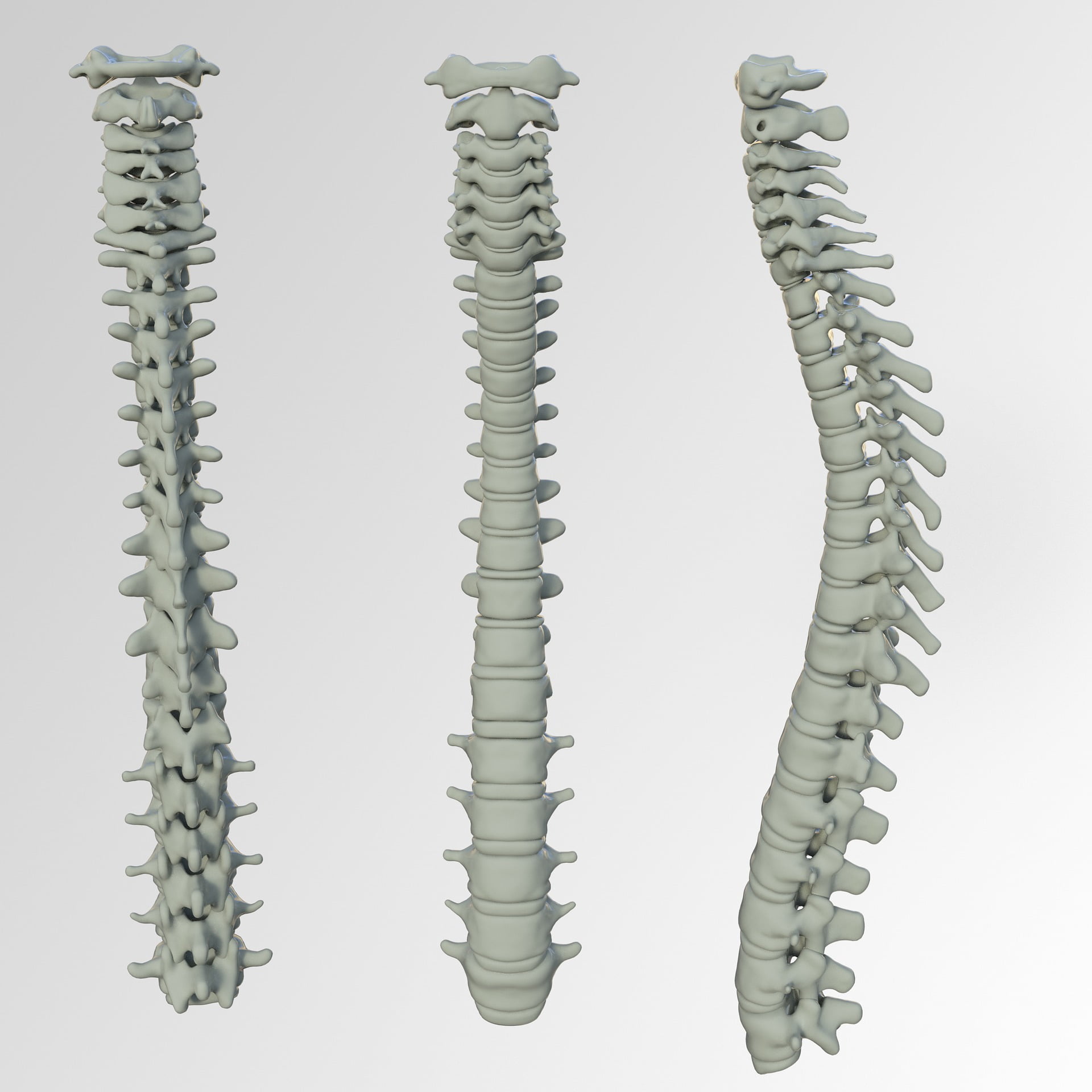 Zimmer Biomet, Medtronic lead Mexico Spinal Implants Market Despite Unfavorable Clinical Studies and Reimbursement Coverage