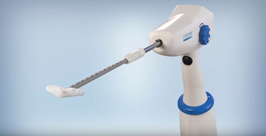 FDA Approves Channel Medsystems’ Endometrial Cryoablation Device