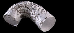 Gore Receives FDA Approval for GORE® TAG® Conformable Thoracic Stent Graft