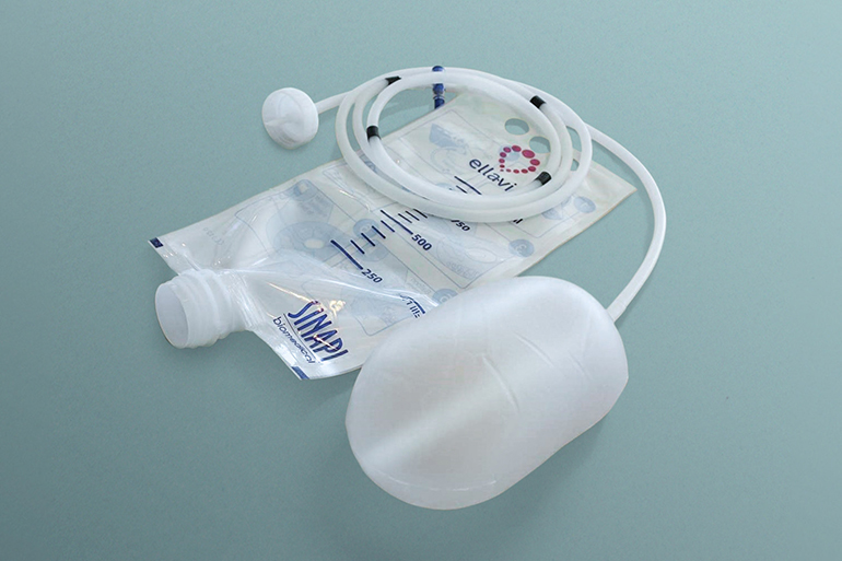 PATH and Sinapi Biomedical Launch Ellavi, a Lifesaving Medical Device to Combat Postpartum Hemorrhage