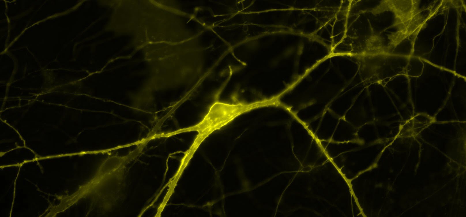 "Voltron” Imaging Tool Captures Brain Cell Action in Living Animals