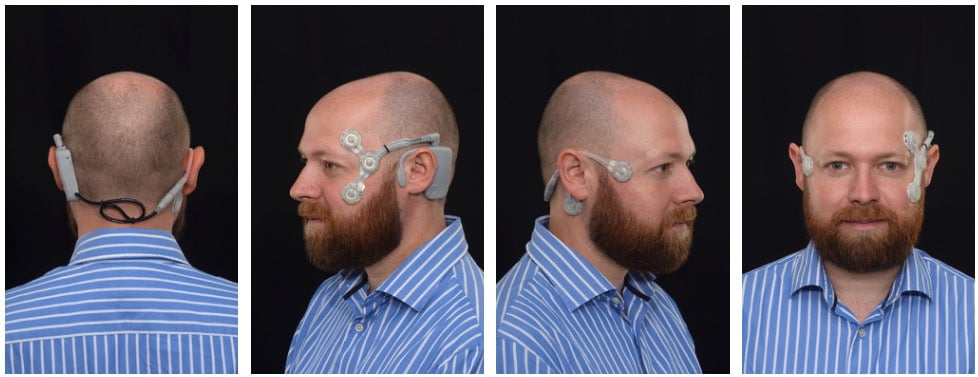 CAVA Device Spots Nystagmus to Diagnose Dizziness