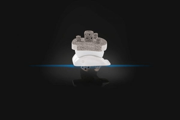 New Fixed Bearing Talus Ankle Implant from Exactech