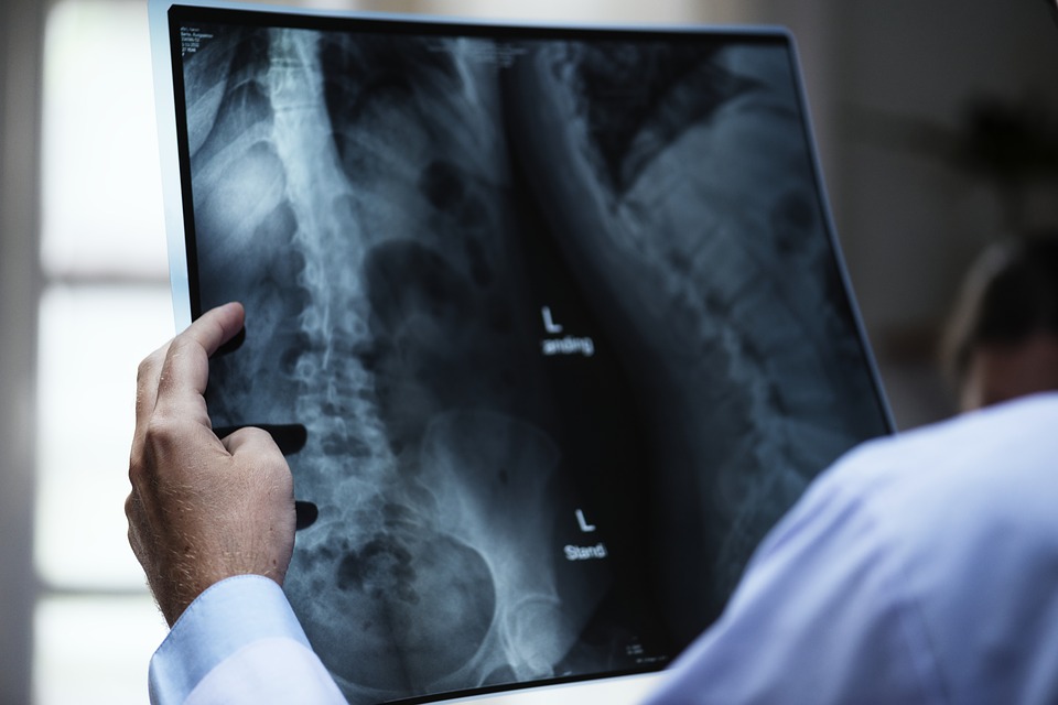 Back Surgery Trends That Will Disrupt Spinal Fusion Procedures
