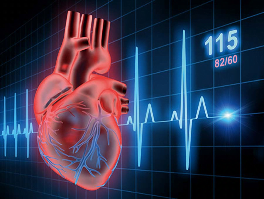 COVID-19 Causes Significant Drop in Interventional Cardiology Procedure Numbers