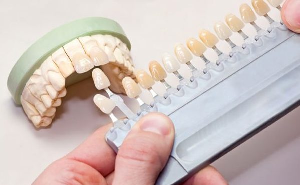 Top 5 Dental Materials Companies in the U.S.