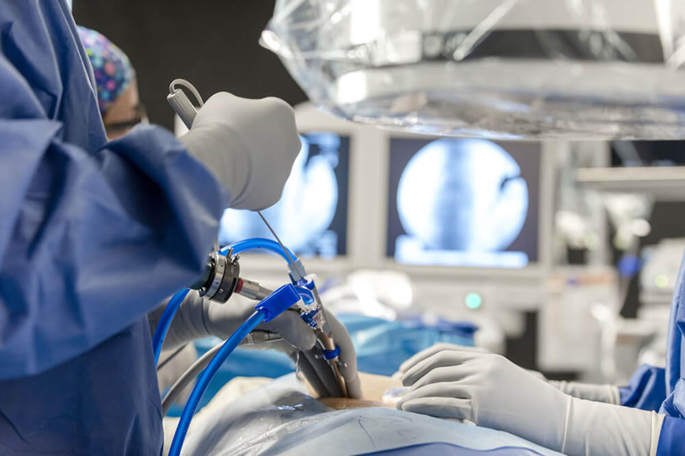 Medtronic has announced that the U.S. Food and Drug Administration (FDA) has cleared the use of navigated interbody high-speed drills with the Robotic Guidance System.