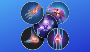 Top Orthopedic Companies in the United States