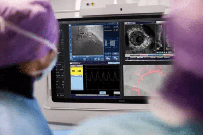 doctors utilizing Philips Intravascular ultrasound device and catheter 