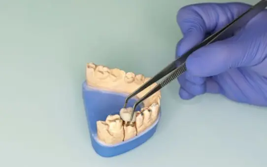 Top Dental Prosthetics Manufacturers in the United States