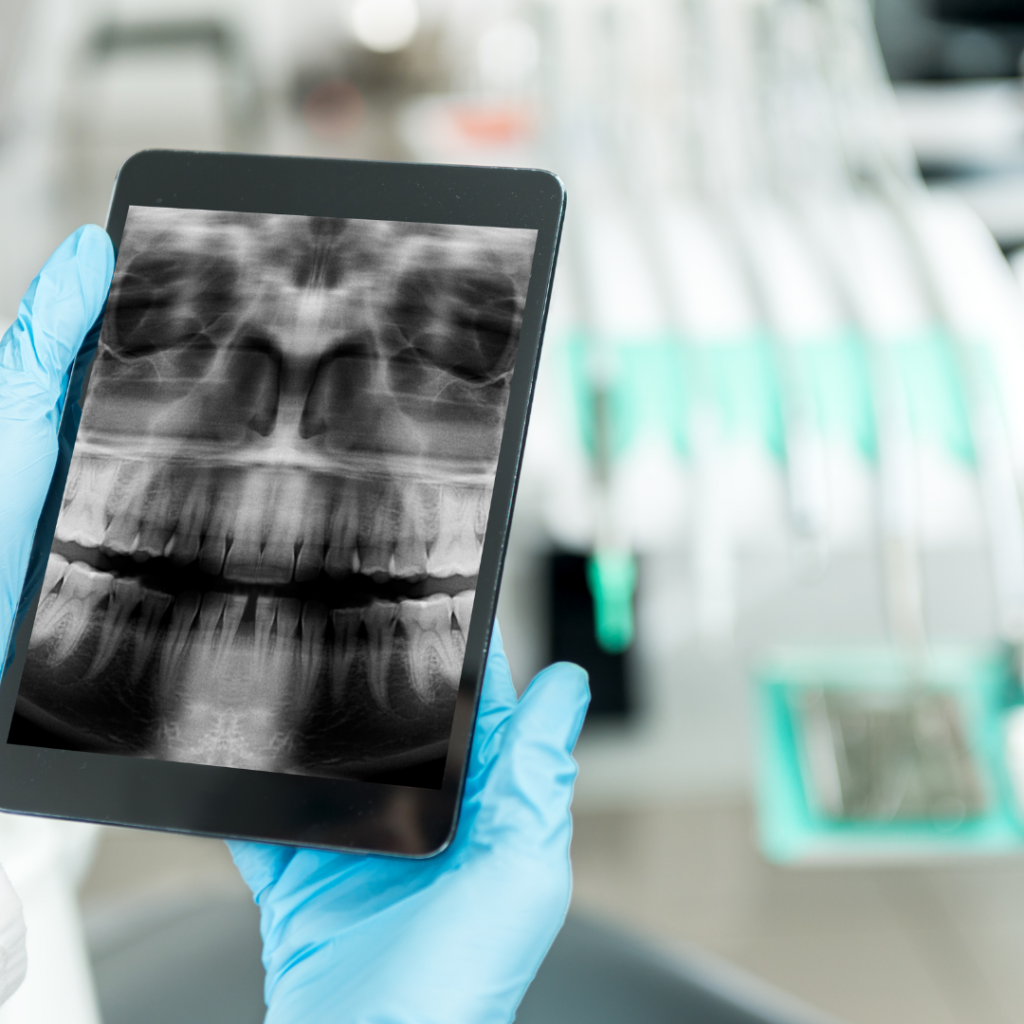 Dental imaging devices