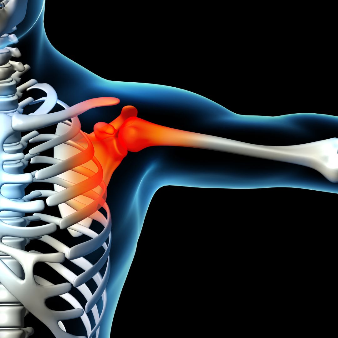 What’s Responsible for Growth in the Shoulder Reconstruction Market?