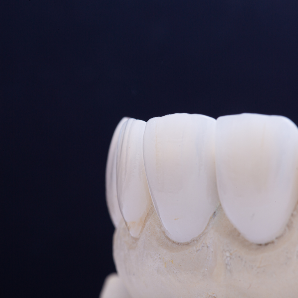 OffLabel Sales and the Latin American Dental Biomaterials Market