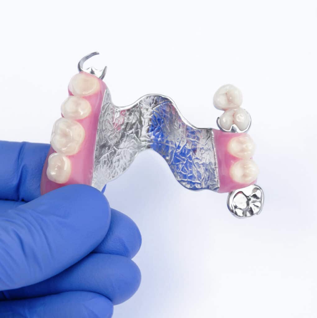 Dental prosthetics