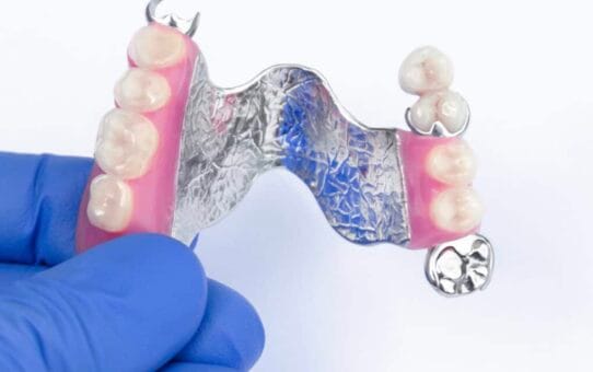 The Impact of Digital Dentistry on the US Dental Prosthetics Market: A Technological Revolution in Smiles