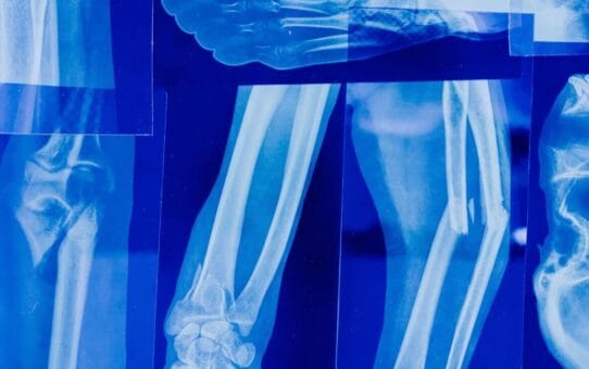 US Medical Imaging 2023 Industry Updates: Advancements Reshaping the Market