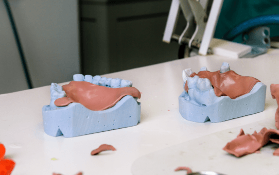 Constraints Limiting Growth in the Asia-Pacific Dental Prosthetics Market: A Comprehensive Country-Level Analysis