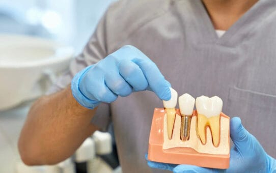 How Dental Implants are Reshaping Asia-Pacific's Dental Bone Graft Substitute Market