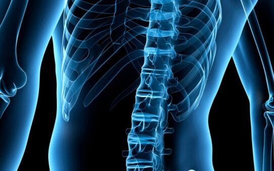 Understanding the Market Limiters in the US Spinal Implant Market