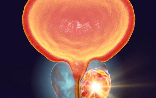 Top Procedure Performed Within the US Urological Devices Market in 2023