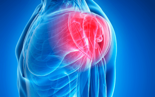 Growing Popularity of Stemless Shoulder Implants in Europe