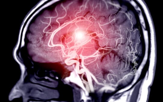 Everything you Need to Know About Aneurysm Clips and the Global Market