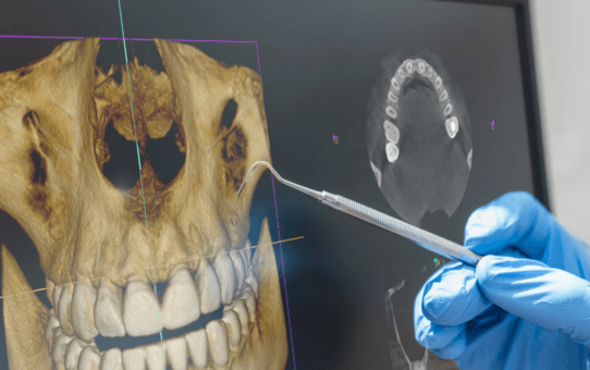 Over 1 Billion Dental Imaging Procedures Performed in the U.S. (2024)