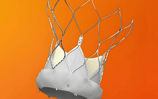 The Future of TAVI: Abbott’s Navitor™ System Reduces Complications and Enhances Recovery