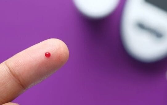 The Ultimate US Diabetes Market Overview in 2025: Trends, Innovations, and Market Growth