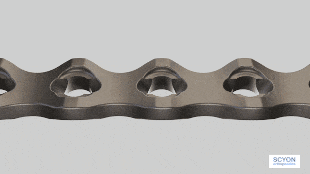 Pažanga traumos prietaiso medžiagose