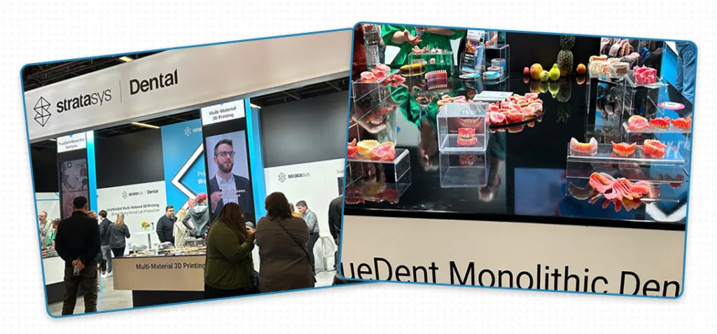 „Stratasys“, „IDS 2025“, „Trutedent“ monolitinis skaitmeninis protezavimas