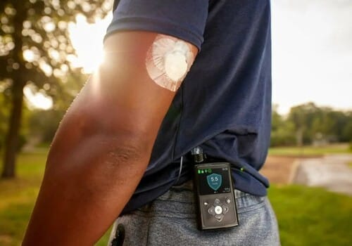 Kodėl „Medtronic“ sukelia savo diabeto verslą