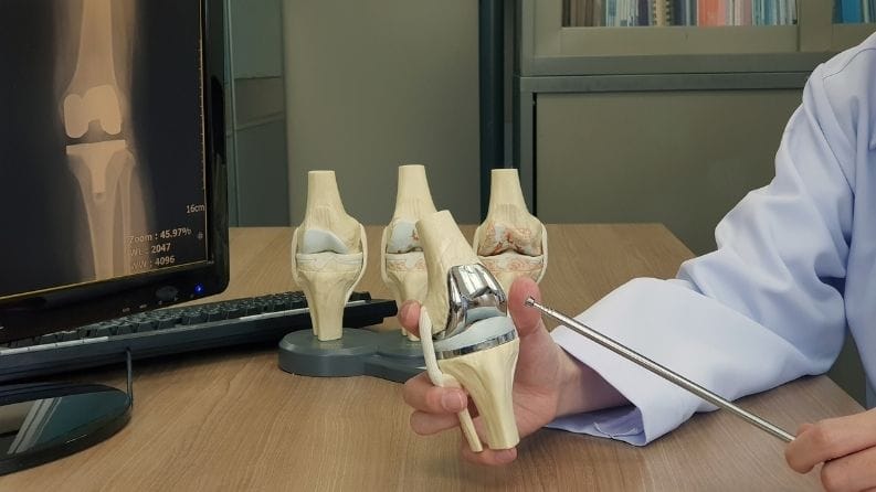 How Tariffs Are Slowing Innovation in Orthopedic Devices