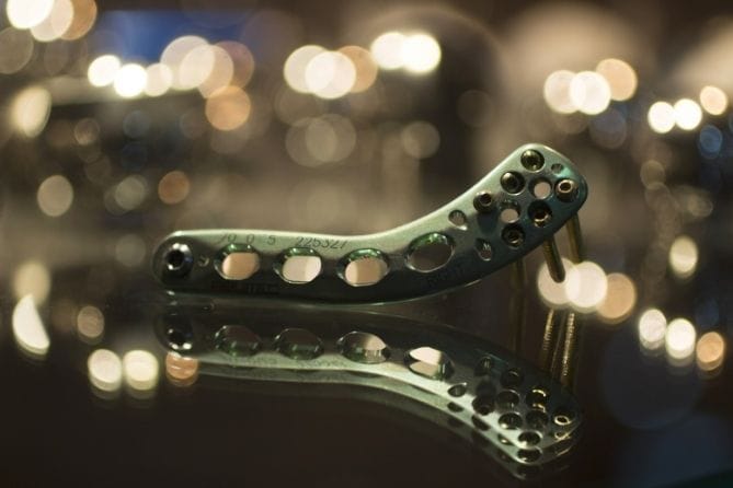 What’s Driving Demand in Small Bone and Joint Orthopedics