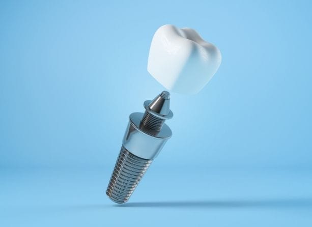 Dental Bone Graft Trends Fueling Implant Growth in Asia-Pacific