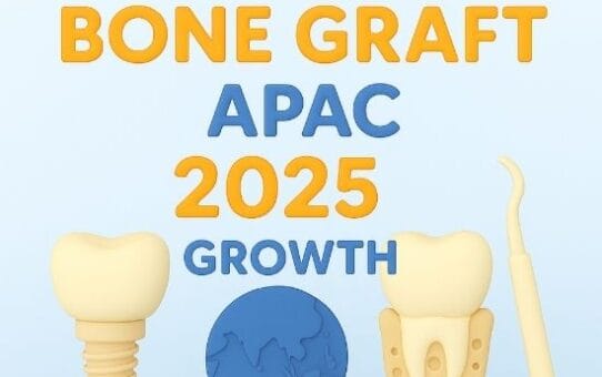 What’s Driving Dental Implant Growth in Asia-Pacific? (Key Trends in 2025)