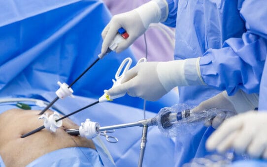 Top 3 Laparoscopic Device Companies in 2026