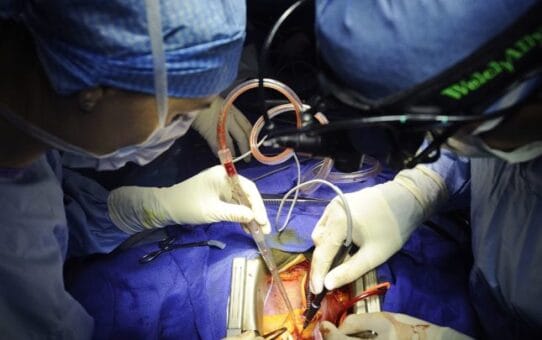 Open Heart Surgery in 2026: What You Should Know